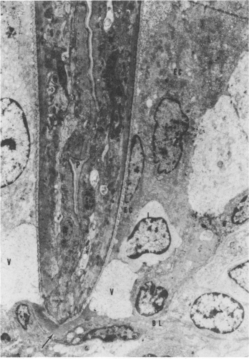 VOL. S, 1992 INTESTINAL CAPILLARIASIS 127 FIG. 13. Electron-microscopic view of the penetrating site of the parasite (P) in gerbil jejunal epithelium.