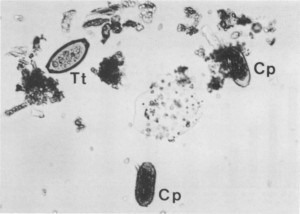 The basal lamina (BL) below the oral tip of the nematode appears deteriorated. Epithelial cells (EC) at the right side are compressed with increased compactness of the cytoplasmic organelles.