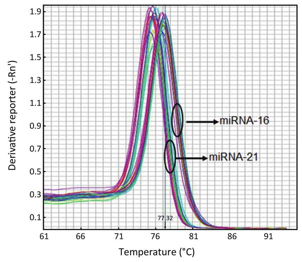 Chinese Journal of Cancer Research, Vol 25, No 6 December 2013 745 Figure 1 The melting curve of mir-21 and mir-16. Figure 3 mir-21 expression in breast cancer patients and healthy controls.