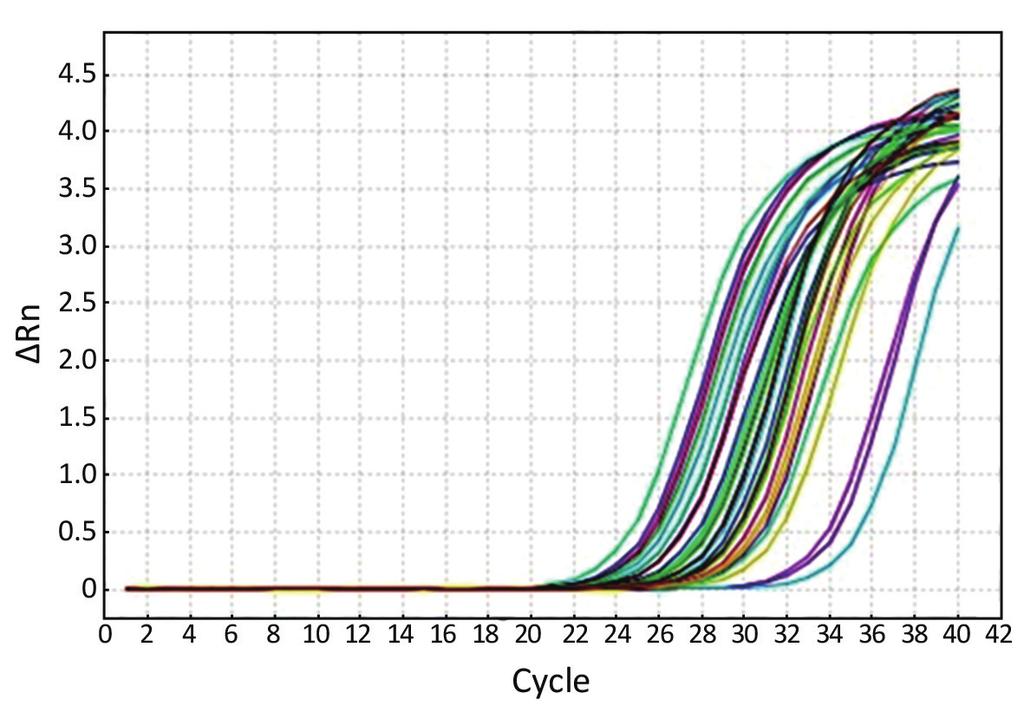 mir-21 expression in BC We have evaluated the expression of mir-21 in 89 BC patients and 55 healthy controls. The relative expression of mir-21 in BC (30.