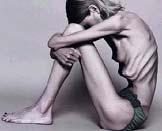 There s no such thing as too thin Anorexia is not limited by only a refusal to eat, is common practice in anorexia.