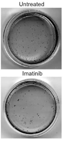 TKIs do not target CML stem cells Progenitors cells Short-term colony formation assay 150 CML Stem cells Long- term colony formation assay 150 (LTC-IC) number colonies (% of untreated) 100 50 number
