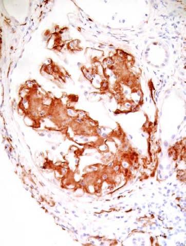 Immunohistochemistry Useful for detecting amyloid