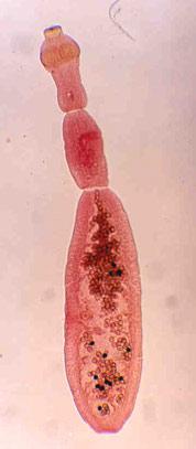 Echinococcus granulosis A.K.