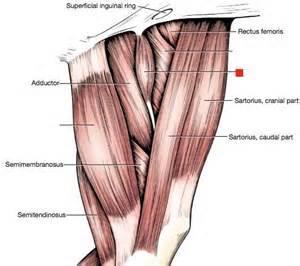 Gracilis Muscle Contracture Normal anatomy o Origin pelvic symphysis o Insertion cranial border of