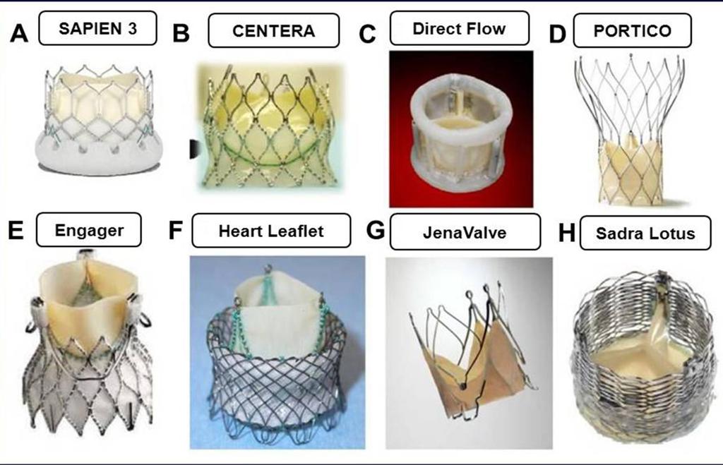 Emerging TAVR Devices Involving Improved