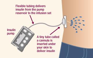 Page 9 Insulin Therapy Formulations Vials Pen devices SC pumps CSII (continuous subcutaneous insulin infusion) Insulin Therapy Vials: drawing up insulin dose Wash hands and sterilize top of insulin