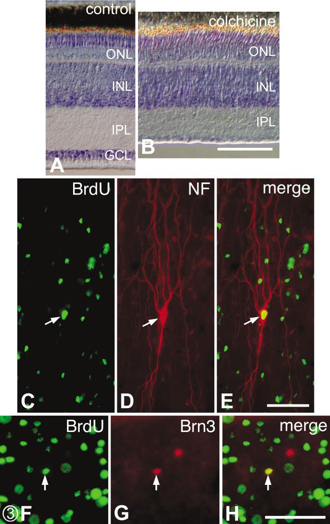 74 FISCHER AND REH Fig. 3. Ganglion cells are regenerated in colchicine-damaged retinas.