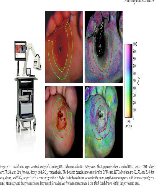 circulation Hyperspectral Imaging Vascular reactivity in the lower