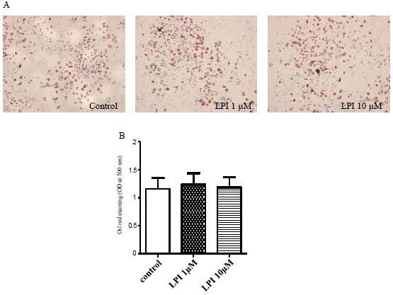 Representative bright-field images of 3T3-L1 cells differentiated to adipocytes during 10 days in the absence (left panel) or presence of 1 M and 10 M LPI (right