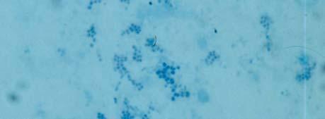 GRANULOMAS Mycobacterium leprae