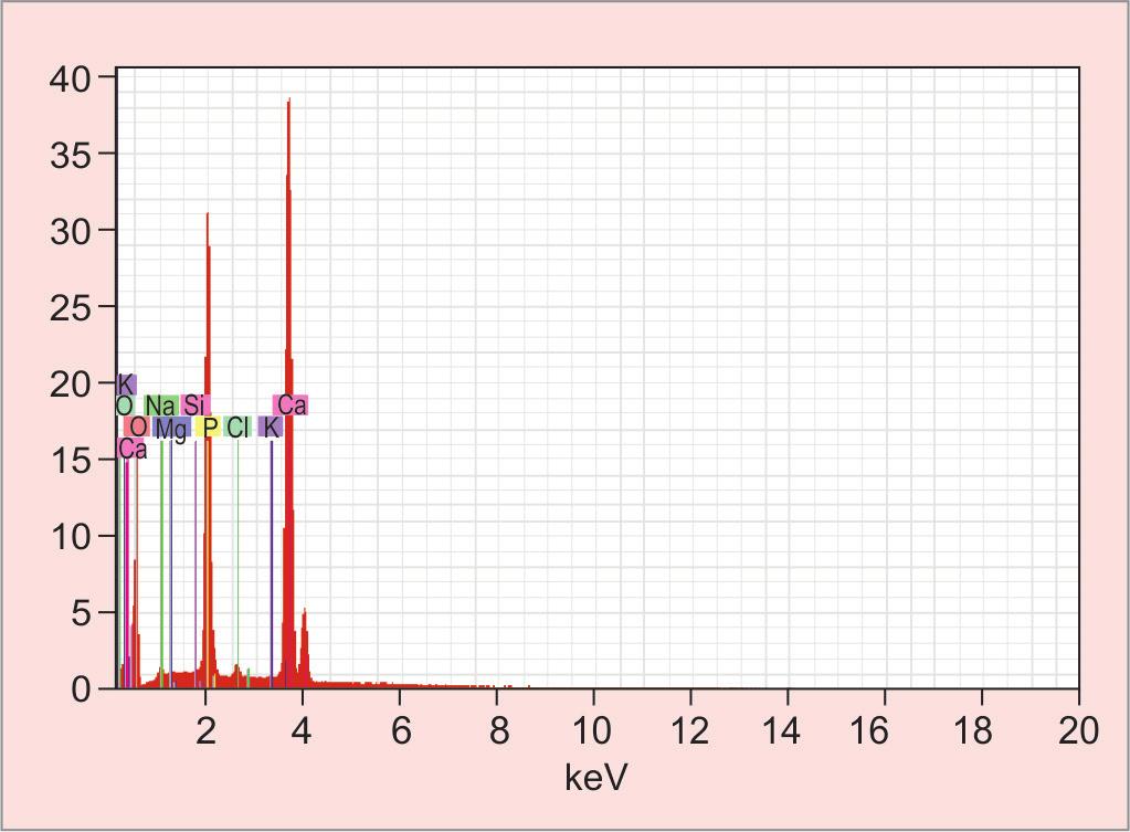 5 hours Graph 6: X-ray diffraction pattern of the tooth enamel bleached using 35% H 2 O 2 for 3 hours 0.3450, the average composition of calcium from each treatment was 3.