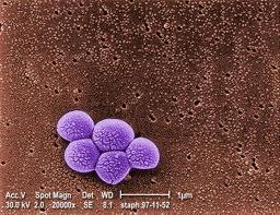 Introduction MRSA: Remains a leading cause of hospital-acquired infection(healthcare-associated, HA-MRSA) Also causing community outbreaks (Community-associated, CA- MRSA).