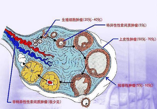 Histologic Classification germ cell sex cord stroma
