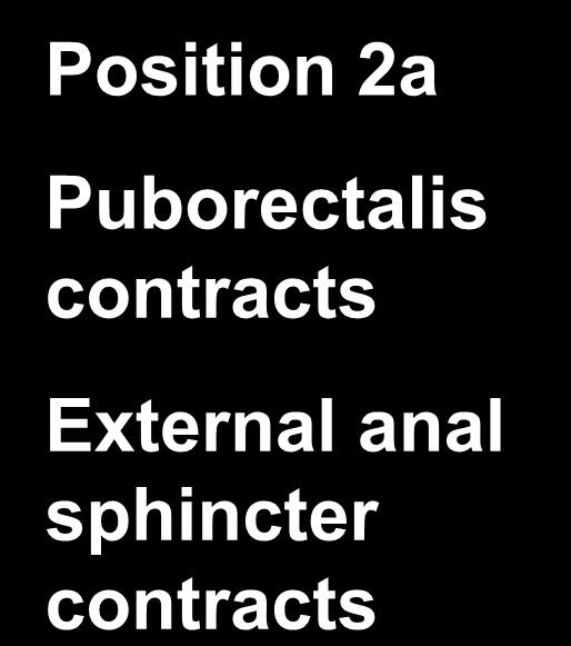 Digital Exam - Squeeze Position 2a Puborectalis contracts External anal sphincter