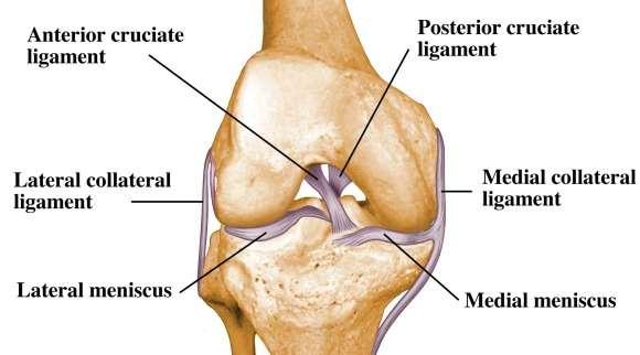 ACL Surgery ACL = anterior cruciate ligament PCL = poster cruciate