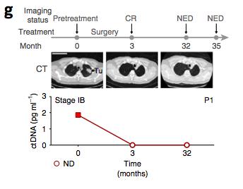 early-stage NSCLC CAPP-Seq allows monitoring in early stage NSCLC. Patients P1/P16 : surgery and stereotactic ablative radiotherapy for stage IB NSCLC.