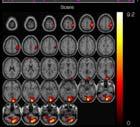 (fmri experiment) Comparison with GLM Approach R L The same slice from nine subjects when the right (red) and left (blue) visual fields were stimulated, (a) analyzed via linear modeling (LM), (b)
