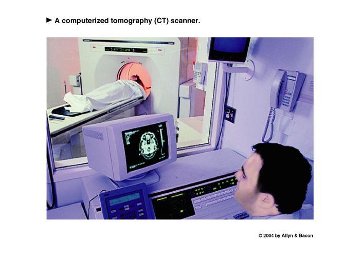 Computerized Tomography (CT)!