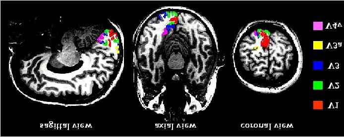 The Functional MRI (fmri): Organization of the Visual Cortex Visual cortex can be separated into visual areas, each with a complete mapping of the twodimensional