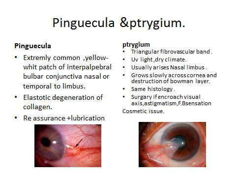 Gonococcal Conjunctivitis Occurs 2-7 days after birth More severe than other forms Bilateral purulent discharge May progress to corneal involvement with perforation or endophthalmitis Possible