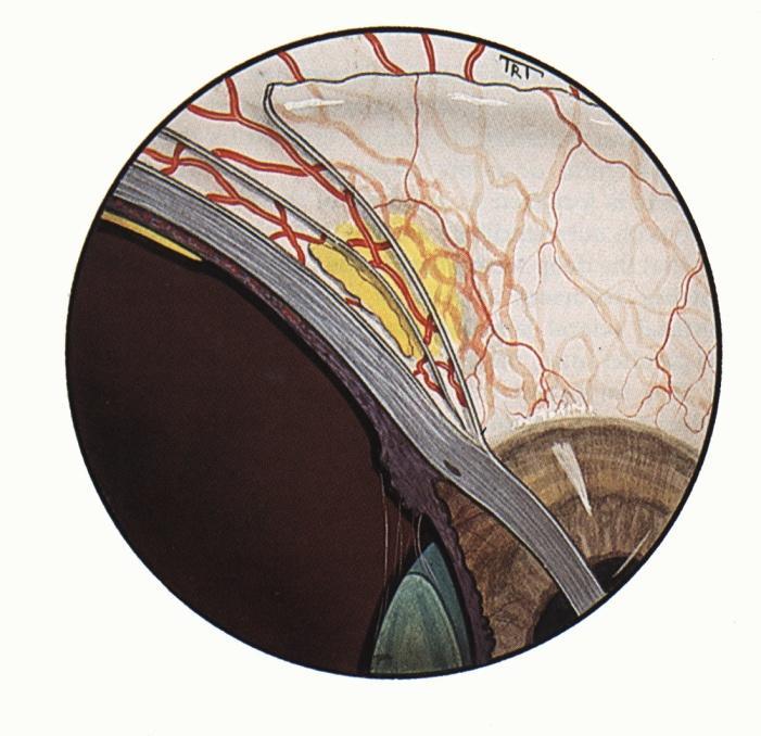 Applied anatomy of vascular coats Normal