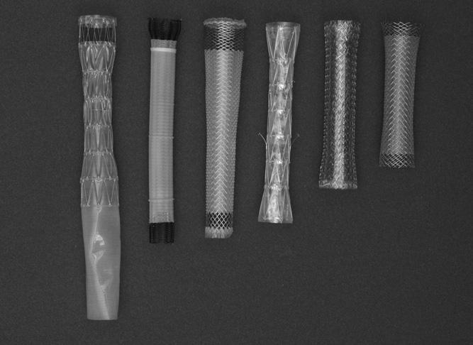 7 Results from animal studies have shown the feasibility of placing expandable biodegradable biliary stents for management of bile duct leaks 8 and human studies using these devices in benign disease