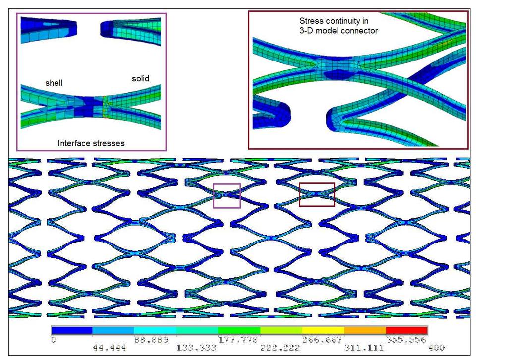 Figure 6. Equivalent stresses in shell and solid elements (mixed model), MPa. Table 2. Stent s natural frequencies (undamped, Hz). Mode # Beam Beam/Solid Shell Shell/Solid Solid 1 0.564 0.503 0.880 0.