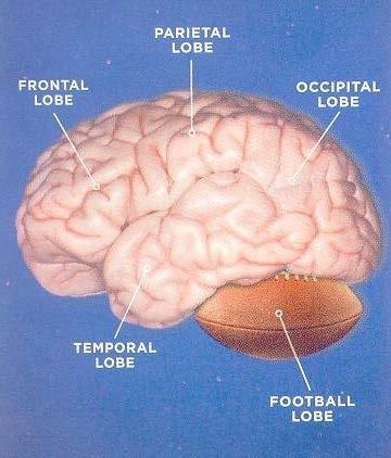 Late Effects of Concussion CTE = Chronic Traumatic Encephalopathy NOT the accumulation of symptoms from previous injuries Progressive decline