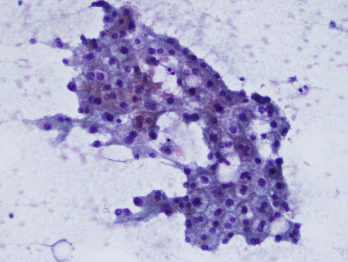 Benign hepatocytes