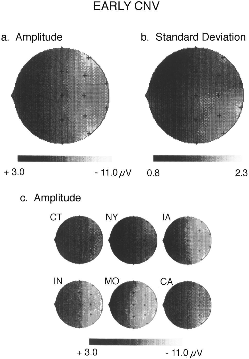 116 J.W. Rohrbaugh et al. r International Journal of Psychophysiology 25 1997 111 122 Fig. 3. Maps depicting the topographic distribution of the grand averaged Early CNV measure Ž.