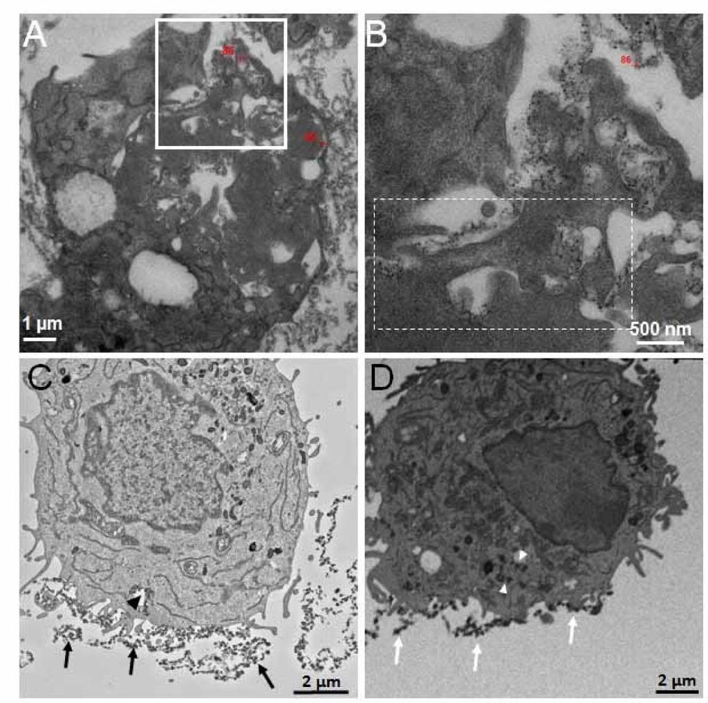 Figure S1. TEM and FIB-SEM images of a J774 cell interacting with gold-labeled agldl.