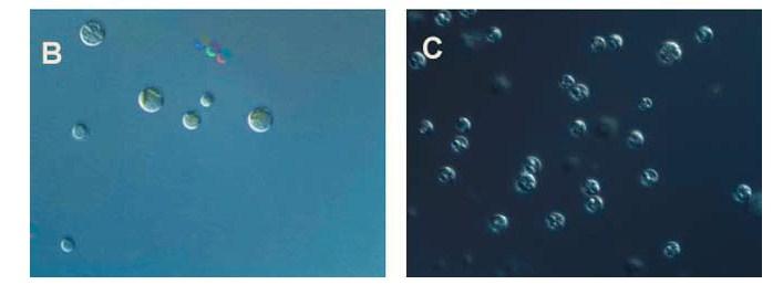 Figure 2.9 Cells of autotrophic and heterotrophic C. protothecoides under differential interference microscopy. (B) Almost no lipid vesicles were observed in autotrophic C. protothecoides cells.