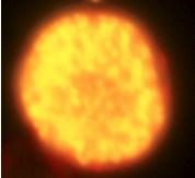 Figure 4.2 Yellow dots representing oil globules in algal cells under fluorescence microscope.