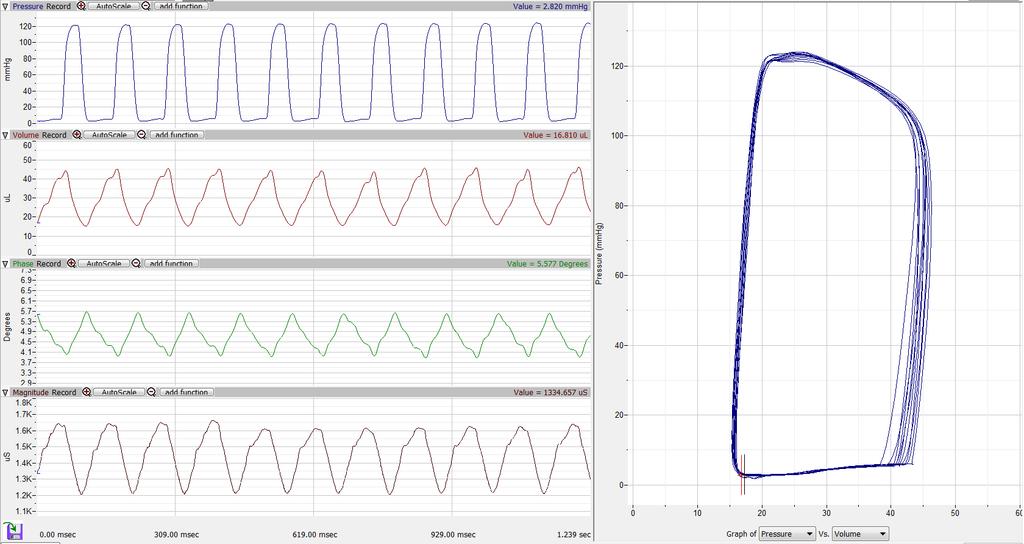 HIGH-RESOLUTION ECHO COMPARISON FROM A HEALTHY MOUSE On the far left, XY plots show Admittance (blue) and Conductance (black) PV loops in two different scenarios: central Catheter position (top) and