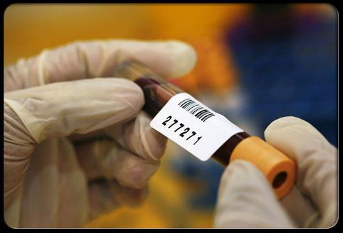 Another test done on a blood sample can determine the level of a protein (prostate-specific antigen or PSA) produced by prostate