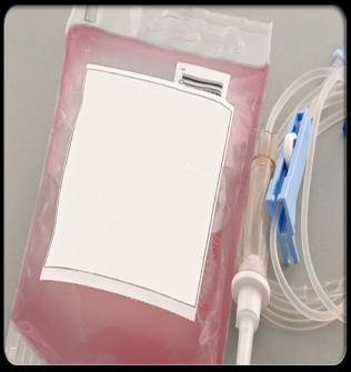 Usually, chemotherapy is given through a special intravenous line in a series of treatments over several months.