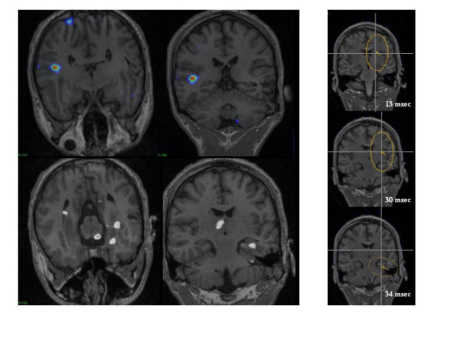 Predicting white matter targets for direct