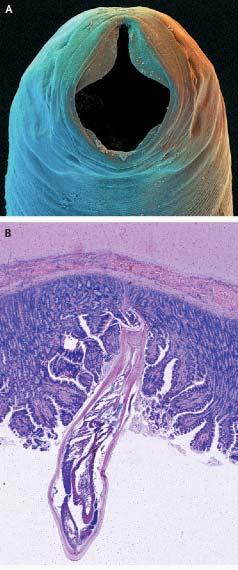 Necator americanus Adult worms use cutting apparatus to attach to intestinal mucosa Contract muscular esophagi to