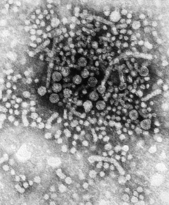 Hepatitis B Virus (HBV) Hepatitis B Virus