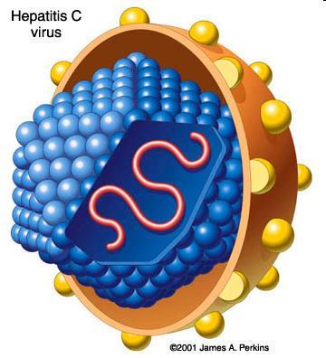 Viral Hepatitis : Hepatitis C Blood borne, not in food or water; not highly sexually transmitted*