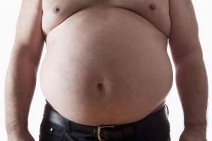 Case 6 46 year old European man Feeling tired Gaining weight Wt 120kg, BMI