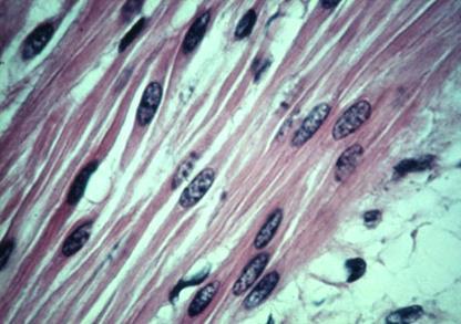 Smooth muscle - Summary Found in walls of hollow internal organs Involuntary
