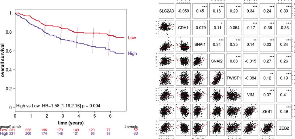 Masin et al. Cancer & Metabolism 214, 2:11 Page 12 of 14 A OS - B Figure 6 expression correlates with poor overall survival and EMT in human NSCLC.
