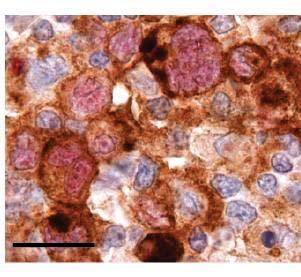 Commercial Diagnostic Assays Additional IHC assays Cell Signaling Technology Hodgkin Lymphoma Anti-PD-L1 (9A11): Assay