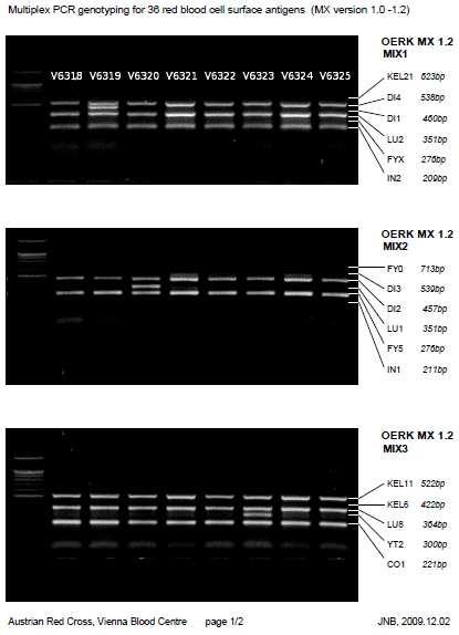 Multiplex PCR screening for 35 RBC antigens Jungbauer