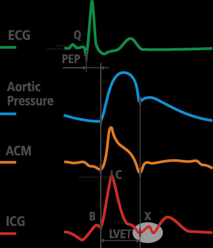 ACM Arterial Compliance Modulation How does ACM work?
