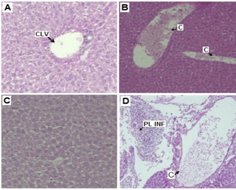 C: congestion, INF: inflammatory infiltrate. Fig. 4 : Hepatic histological sections of a male and female control group (A and C) and treated mice (B and D) with 100 mg/kg of TPME Fig.