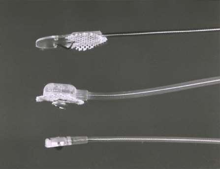Epicardial Leads Leads applied directly to the surface of the heart Fixation mechanisms