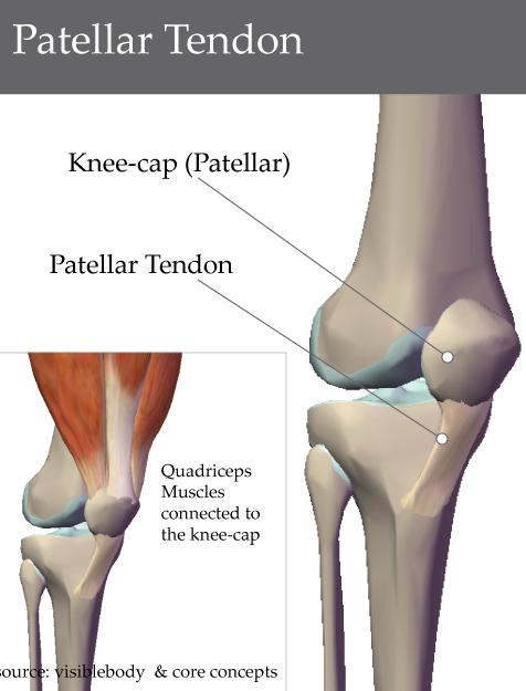 THE PATELLAR TENDON The patellar tendon is the structure that connects the patella (knee cap) to the tibia (shin bone).